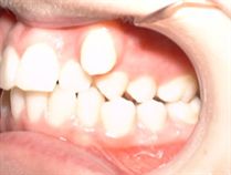 D22910178 D22910178