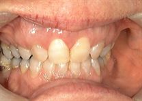 D229125135 D229125135