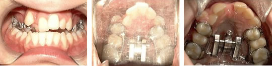 ctbs-c4a ctbs-c4a