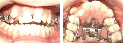 ctbs-c4b ctbs-c4b